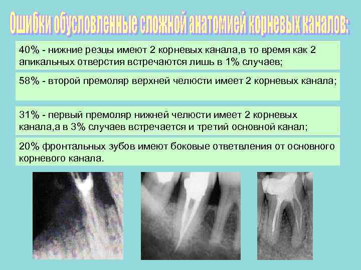 Корневые каналы постоянных зубов