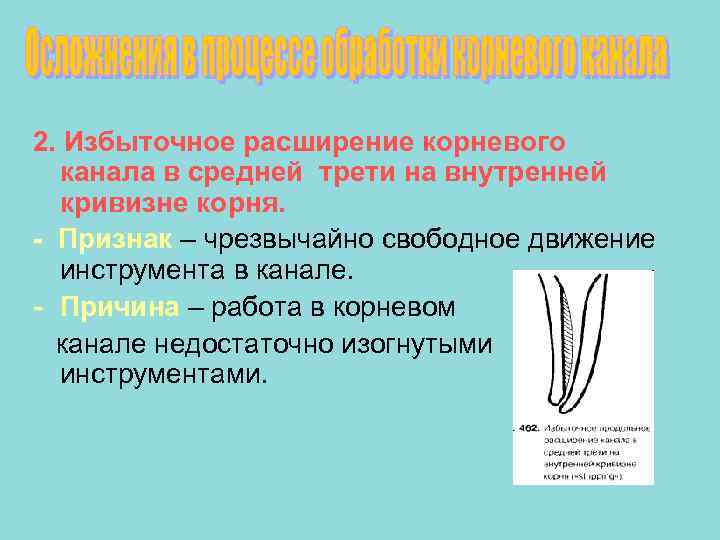 Трети корневого канала. Расширение корневого канала в средней трети. Корневой канал расширяют. Расширение одногого корневого канала. Степень кривизны корневых каналов.