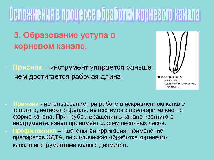   3. Образование уступа в корневом канале.  - Признак – инструмент упирается
