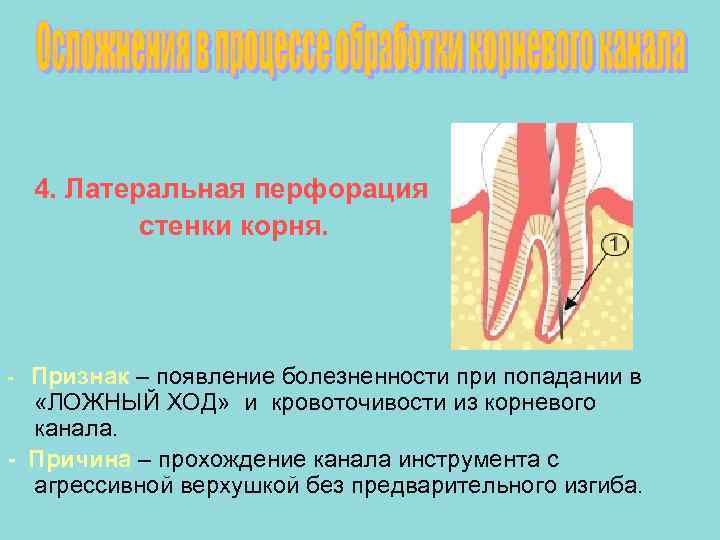 Рентгенография в эндодонтии презентация