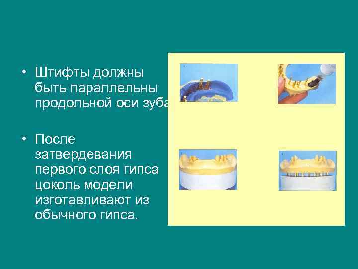  • Штифты должны  быть параллельны  продольной оси зуба.  • После