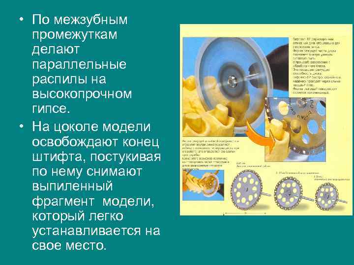 • По межзубным  промежуткам  делают  параллельные  распилы на 