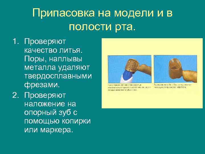   Припасовка на модели и в  полости рта. 1. Проверяют  качество