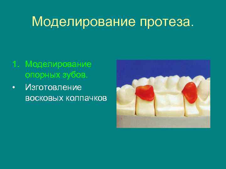   Моделирование протеза.  1. Моделирование  опорных зубов.  • Изготовление 