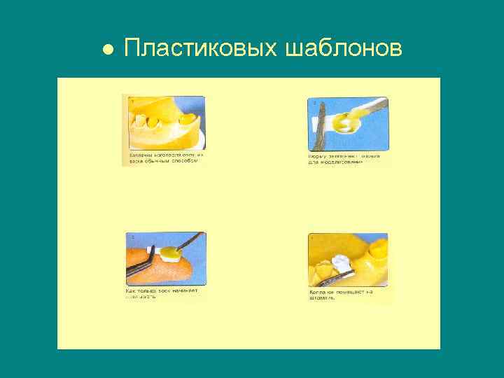 ● Пластиковых шаблонов 