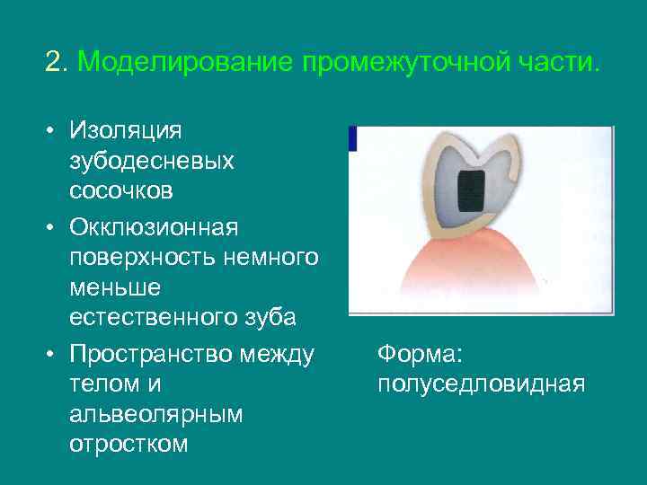 2. Моделирование промежуточной части.  • Изоляция  зубодесневых  сосочков • Окклюзионная 