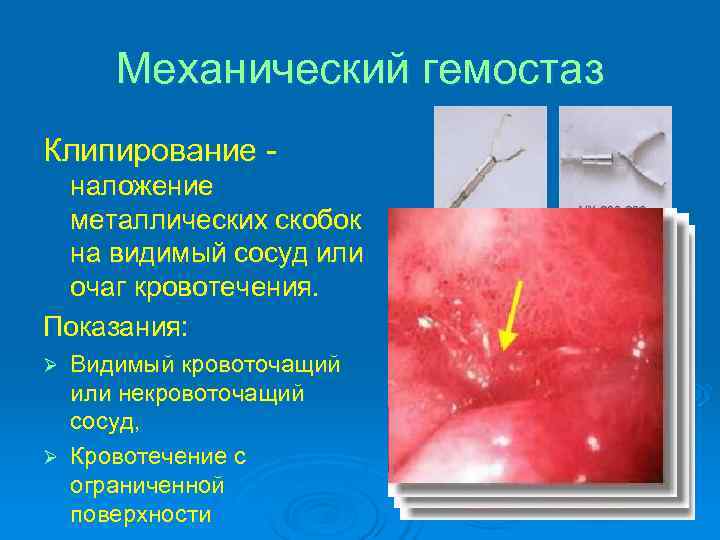 Карта вызова маточное кровотечение неясной этиологии