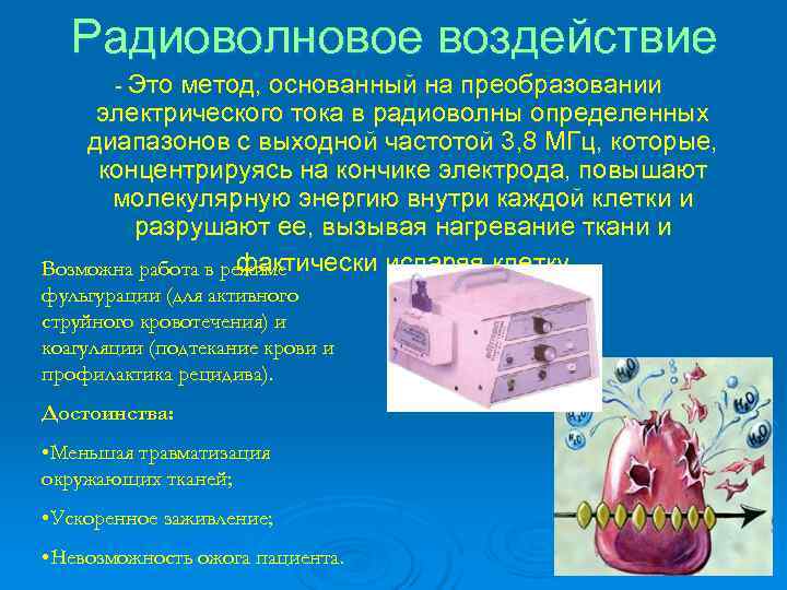  Радиоволновое воздействие  - Это метод, основанный на преобразовании электрического тока в радиоволны