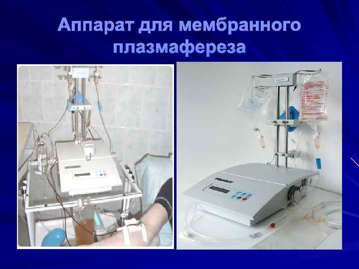 Аппарат для мембранного плазмафереза 