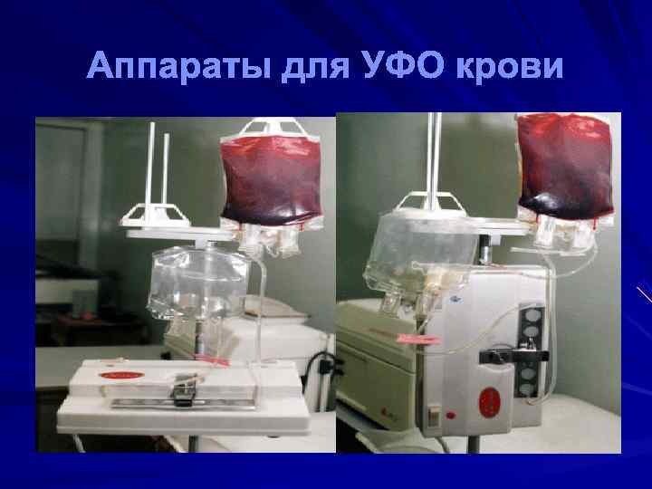 Аппараты для УФО крови 