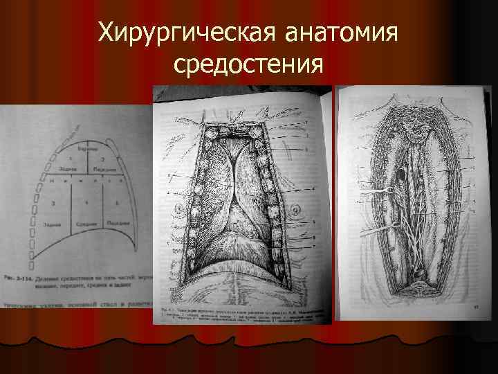 Топографическая анатомия переднего и заднего средостения презентация