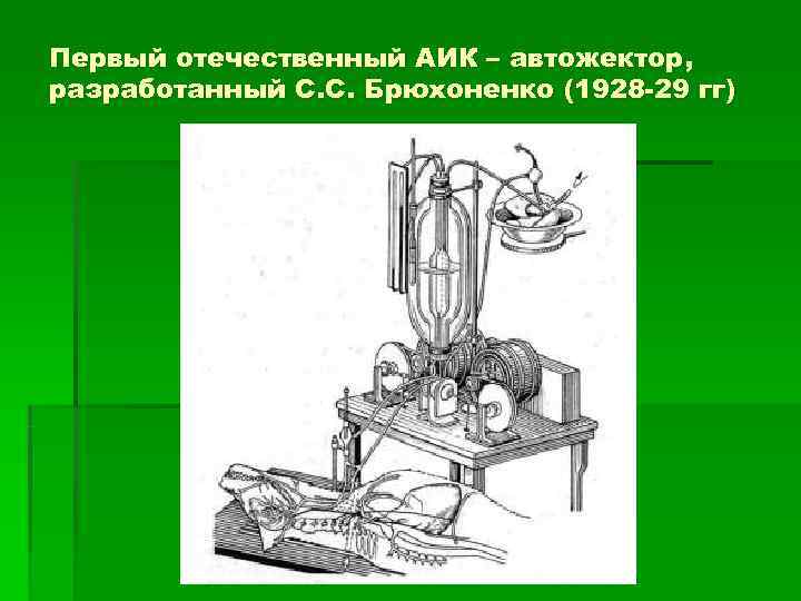 Первый отечественный АИК – автожектор, разработанный С. С. Брюхоненко (1928 -29 гг) 