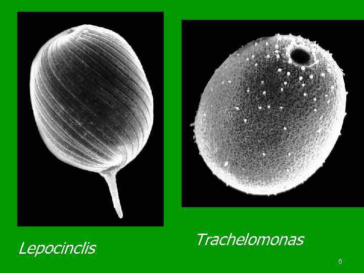 Lepocinclis  Trachelomonas      6 