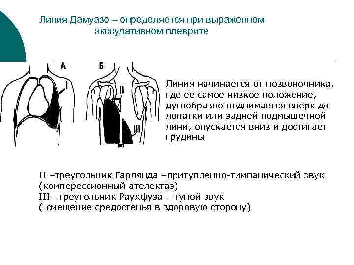 Какая система органов может пострадать если сидеть за партой так как показано на рисунке