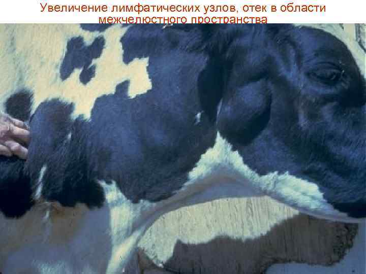 Увеличение лимфатических узлов, отек в области  межчелюстного пространства 