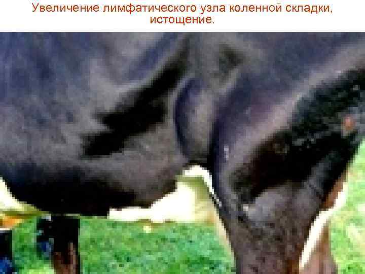 Увеличение лимфатического узла коленной складки,    истощение. 