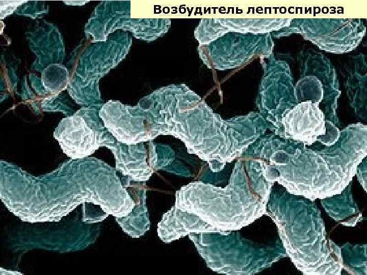 Возбудитель лептоспироза 