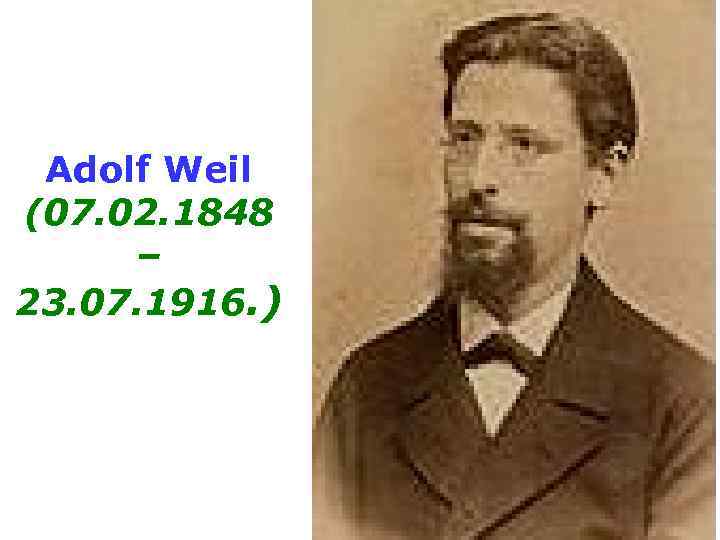  Adolf Weil (07. 02. 1848 – 23. 07. 1916. ) 
