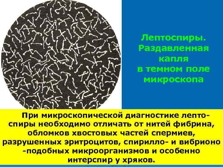       Лептоспиры.     Раздавленная  