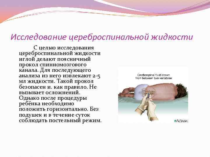 Исследование цереброспинальной жидкости  С целью исследования цереброспинальной жидкости иглой делают поясничный прокол спинномозгового