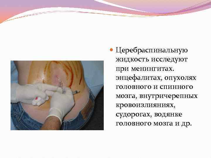  Церебраспинальную  жидкость исследуют  при менингитах.  энцефалитах, опухолях  головного и