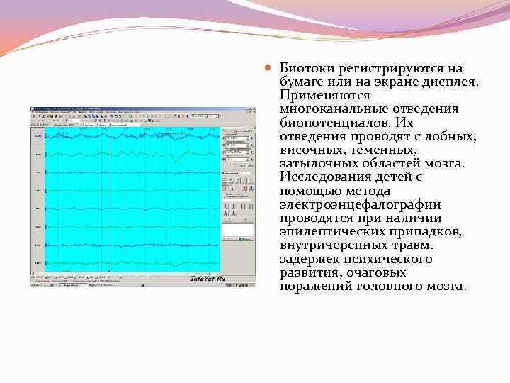  Биотоки регистрируются на  бумаге или на экране дисплея.  Применяются  многоканальные