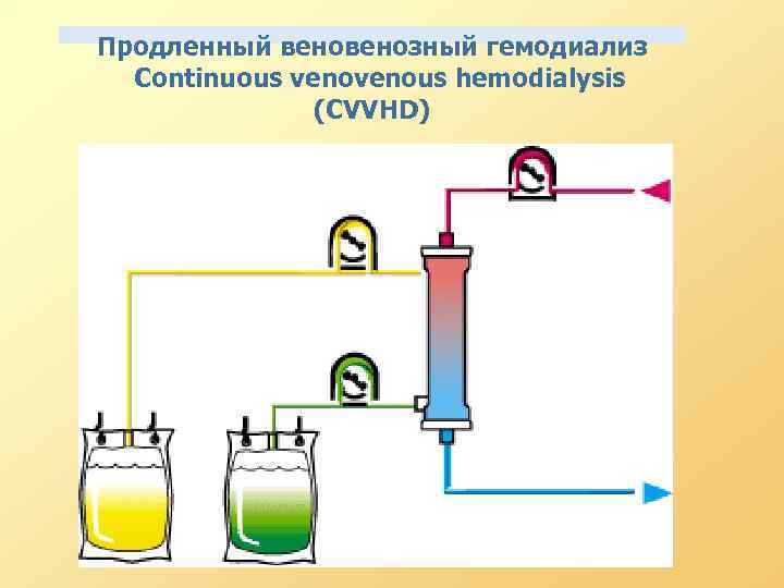 Продленный венозный гемодиализ Continuous venous hemodialysis (CVVHD) 