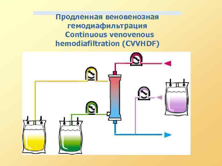 Продленная венозная гемодиафильтрация Continuous venous hemodiafiltration (CVVHDF) 