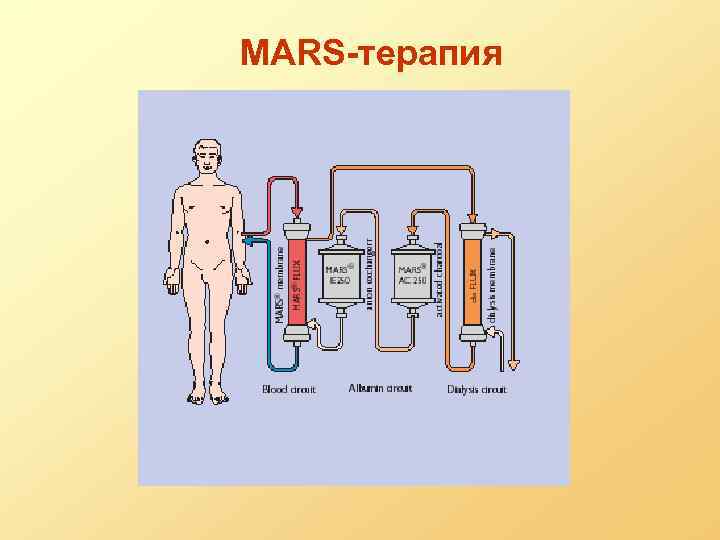 MARS-терапия 