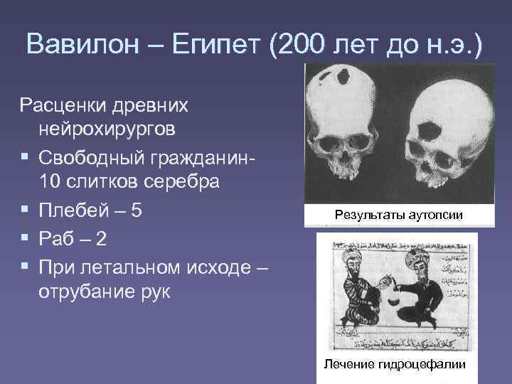 Вавилон – Египет (200 лет до н. э. ) Расценки древних  нейрохирургов 