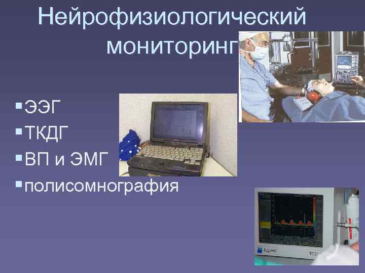  Нейрофизиологический  мониторинг  ЭЭГ  ТКДГ  ВП и ЭМГ  полисомнография