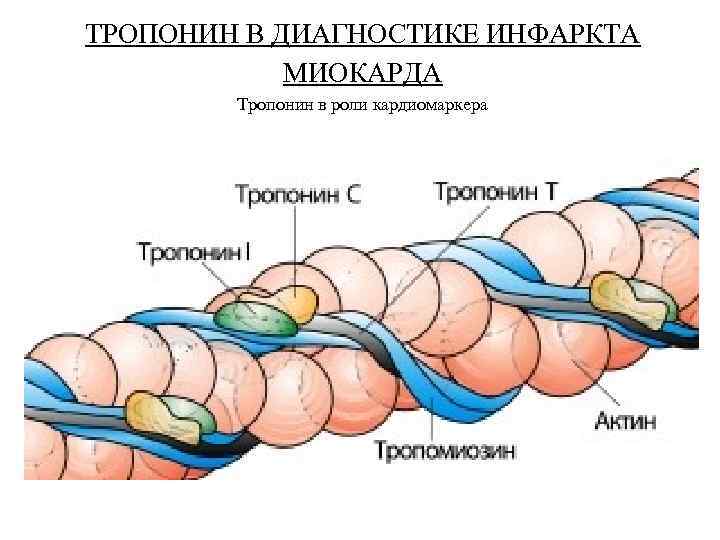 ТРОПОНИН В ДИАГНОСТИКЕ ИНФАРКТА   МИОКАРДА   Тропонин в роли кардиомаркера 