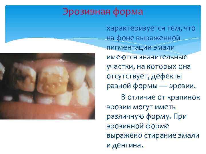 Эрозивная форма   характеризуется тем, что   на фоне выраженной  