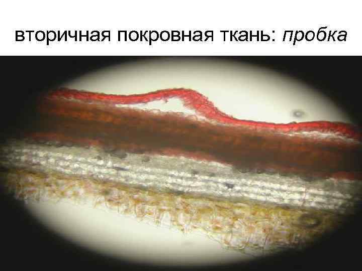 вторичная покровная ткань: пробка 