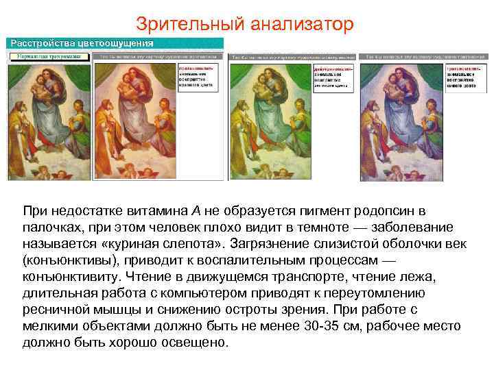     Зрительный анализатор При недостатке витамина А не образуется пигмент родопсин