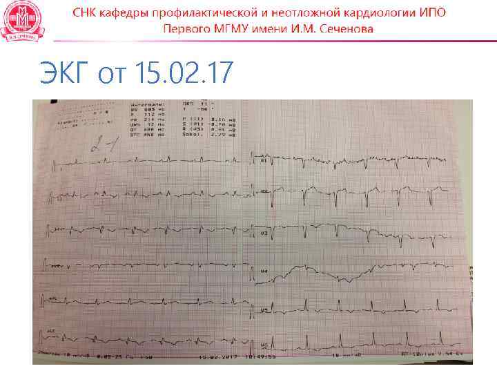 ЭКГ от 15. 02. 17 