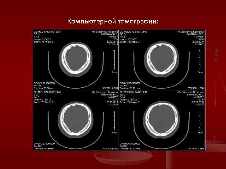 Компьютерной томографии: 
