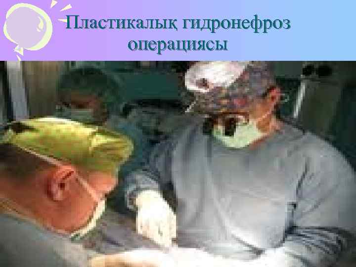 Пластикалық гидронефроз  операциясы 