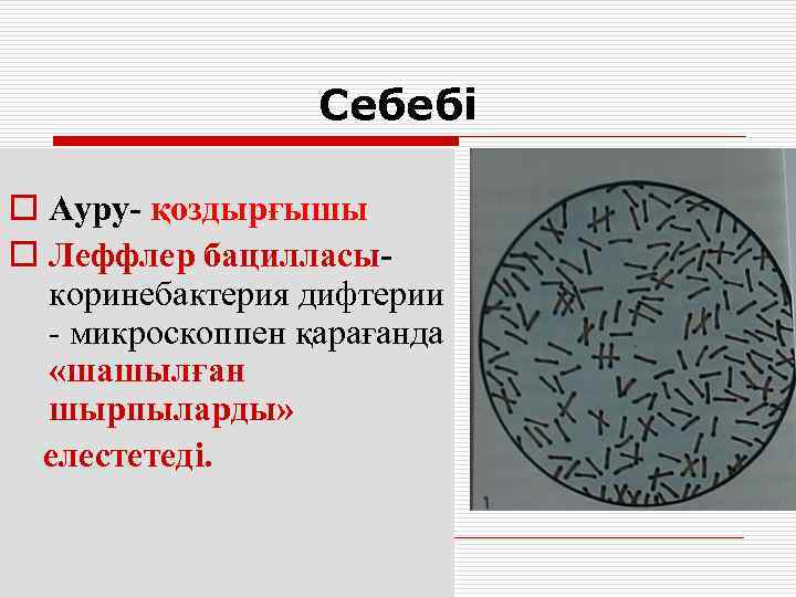    Себебі o Ауру- қоздырғышы o Леффлер бацилласы-  коринебактерия дифтерии 