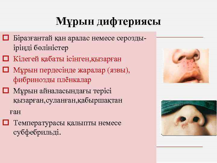    Мұрын дифтериясы o Біразғантай қан аралас немесе серозды-  іріңді бөліністер