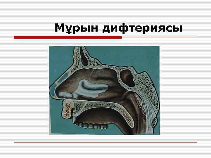 Мұрын дифтериясы 