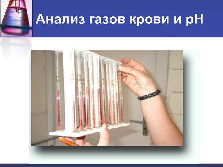 Анализ газов крови и р. Н 