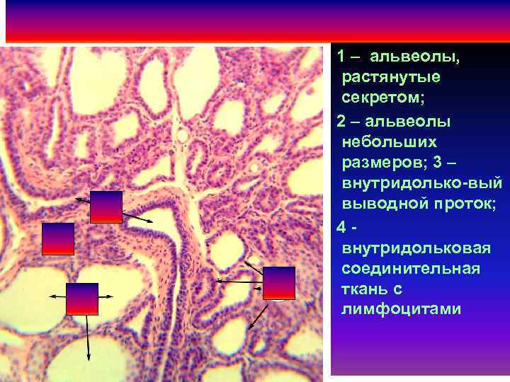 1 – альвеолы, растянутые секретом; 2 – альвеолы небольших размеров; 3 – внутридолько-вый выводной