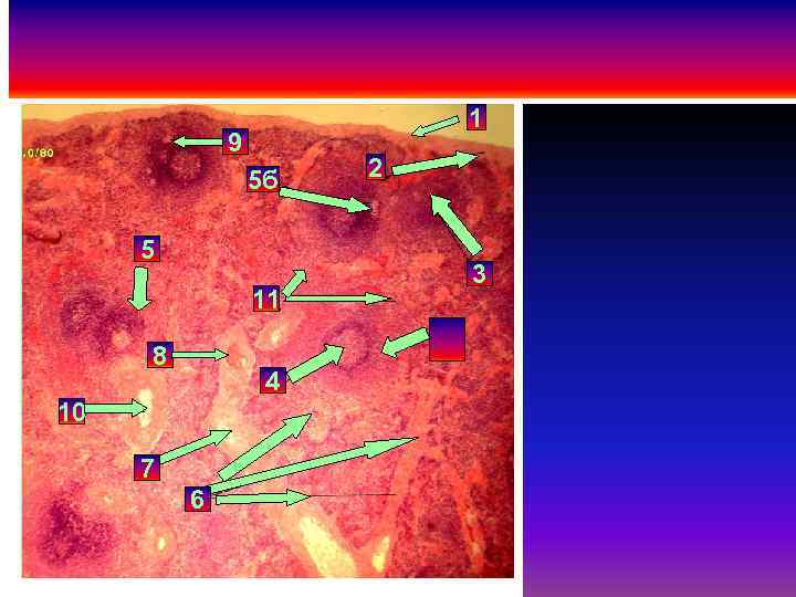 1 9 5 б 5 11 8 4 10 7 6 2 3 