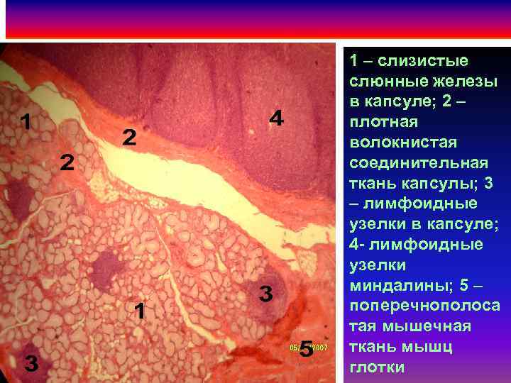 Образует железы. Слизистая соединительная ткань препарат. Слюнные железы образованы тканью. Слюнная железа гистология капсула. Плотная соединительная ткань в капсулах желез слюнных.