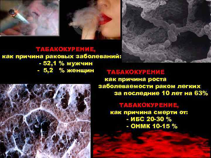    ТАБАКОКУРЕНИЕ, как причина раковых заболеваний:   - 52, 1 %
