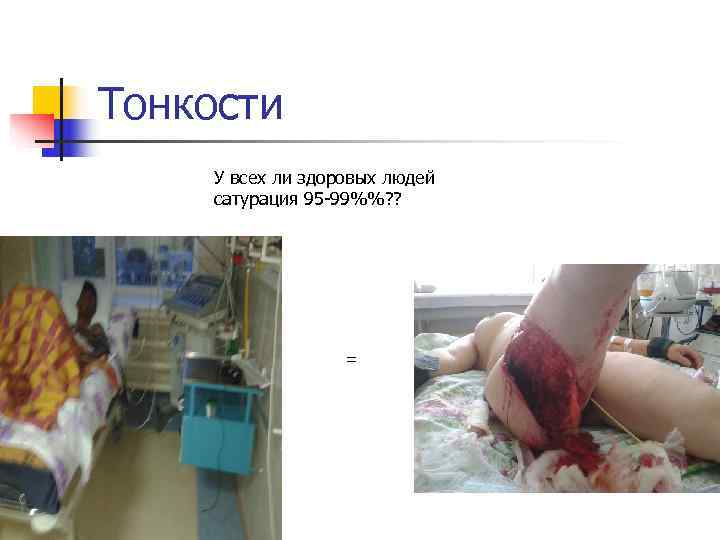 Тонкости У всех ли здоровых людей сатурация 95 -99%%? ?    