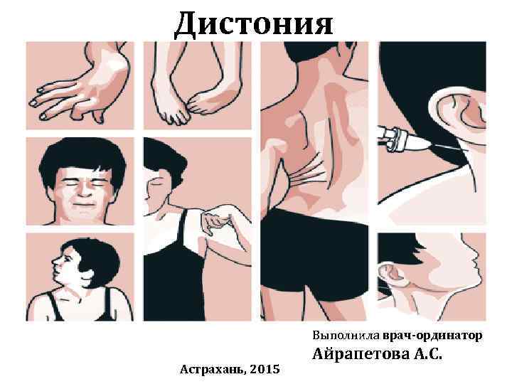 Дистония    Выполнила врач-ординатор    Айрапетова А. С. Астрахань, 2015