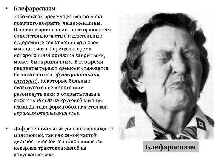  • Блефароспазм Заболевают преимущественно лица пожилого возраста, чаще женщины. Основное проявление - повторяющиеся