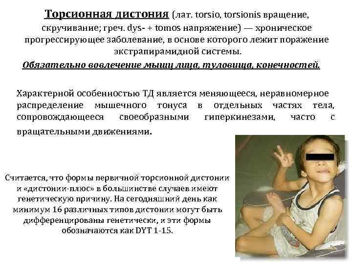   Торсионная дистония (лат. torsio, torsionis вращение,  скручивание; греч. dys- + tomos